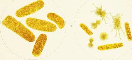 Casts in Urine | Formation & Types | Study.com