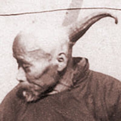 HORNED HUMANS - Wang the Human Unicorn | Human oddities, Human horn, Horns