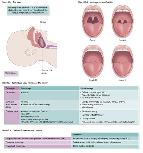 Anaesthetic Airway Assessment