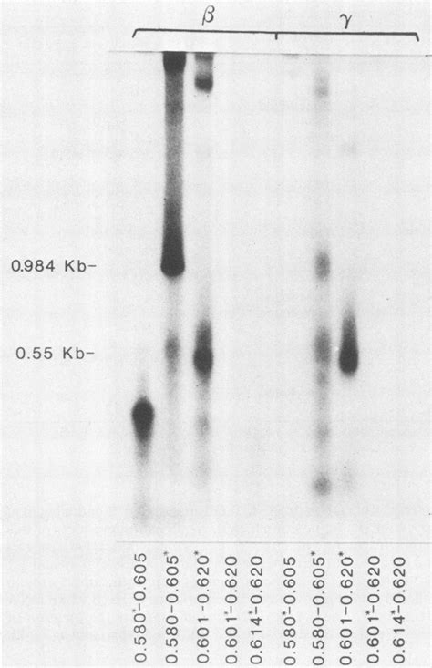 Neutral gel of S1 nuclease mapping. DNA clones labeled at the 5' ends ...