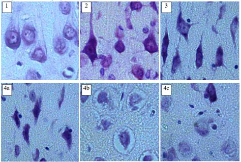 Strangulation Asphyxia Causes Shrinkage and Hyperchromia of Neurons in the Cerebral Cortex of ...