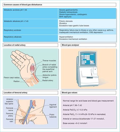 Arterial blood gas sampling | Nurse Key