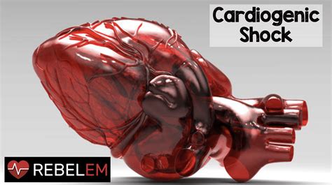 Cardiogenic Shock - REBEL EM - Emergency Medicine Blog