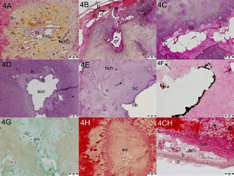 Characteristics of costal cartilages of persons in age more 50 years... | Download Scientific ...