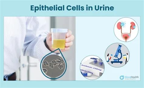 Epithelial Cells in Urine: Normal Range, Causes, How to Reduce