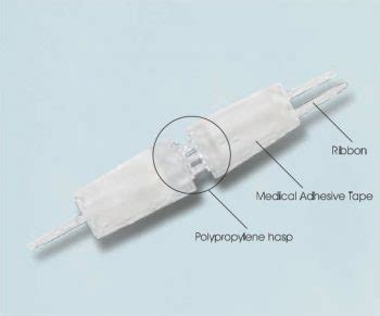 Wound Closure Device - BAIHE MEDICAL EUROPE