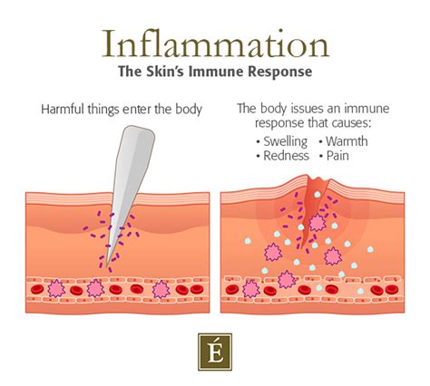 Inflammaging skin: How stress age your Skin | Williamsburg Organic Spa