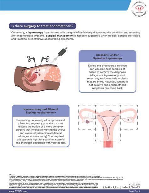 Endometriosis Treatment - Hormonal & Surgical Options (PDF)