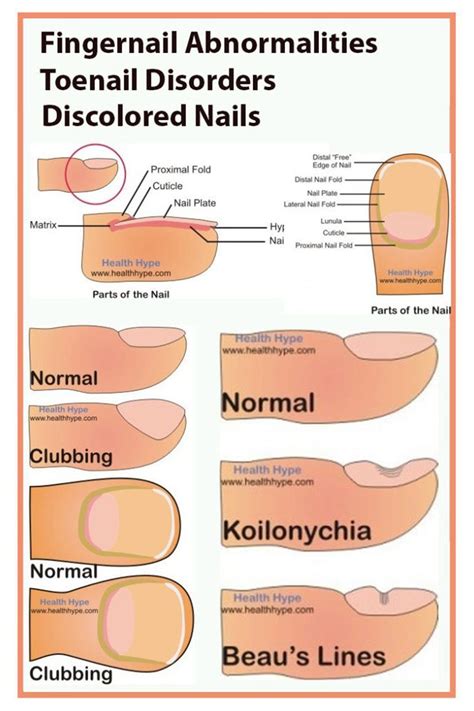 Tips For Nail and Tongue Health Tips - Healthy Natural Magazine | Toe nails, Nail discoloration ...