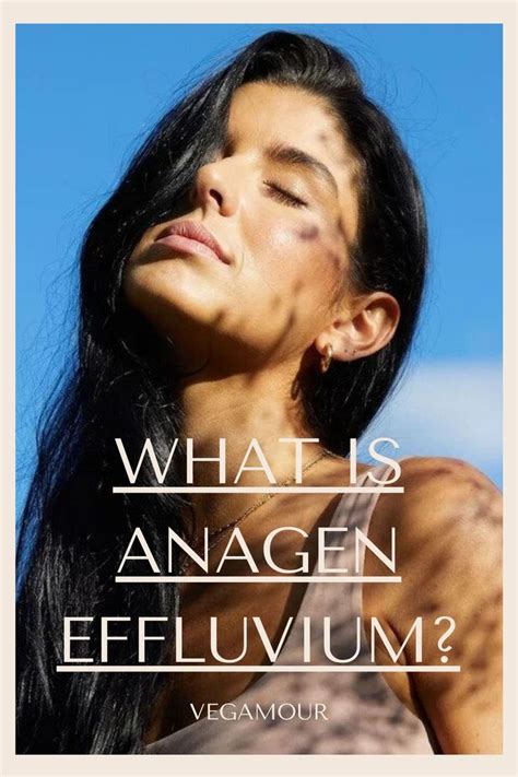 What Is Anagen Effluvium? Causes, Treatments and More in 2021 | Anagen ...