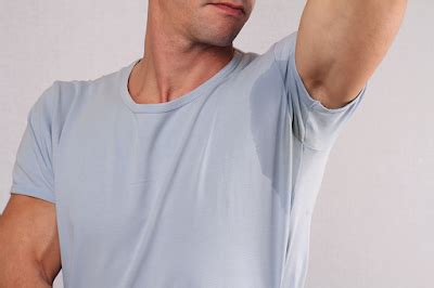 Robinul for hyperhidrosis pros and cons