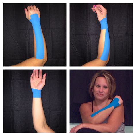 KINESIO TAPPING FOR WRIST SPRAIN : KT Taping