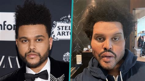 The Weeknd Shocks Fans With Drastically Different Looking Face