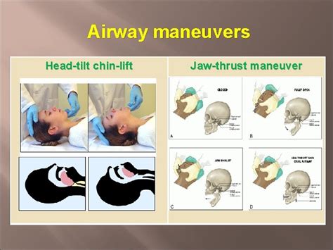 AIRWAY MANAGEMENT Jutarat Luanpholcharoenchai Topic modules Anatomy of