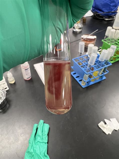 Motility Test : r/microbiology