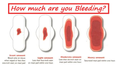 Is Clotting In Periods Normal