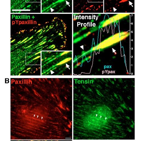 FAK mediates the effect of paxillin phosphorylation on adhesion... | Download Scientific Diagram