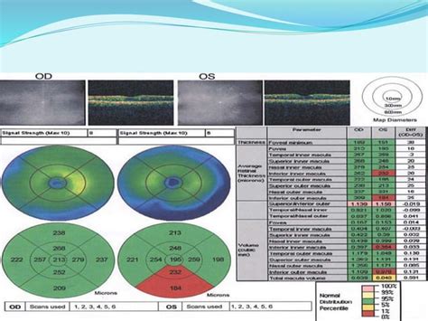 Oct in glaucoma