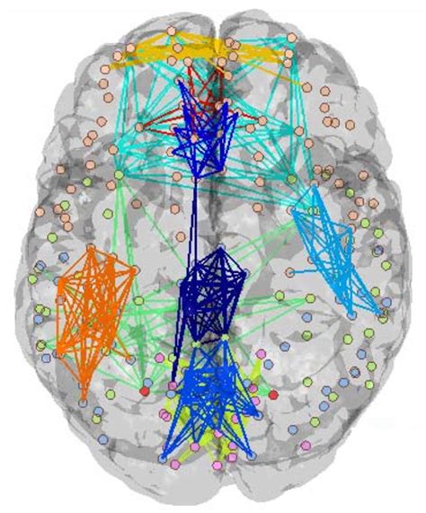 Method provides reference map for brain connectivity patterns | Spectrum | Autism Research News