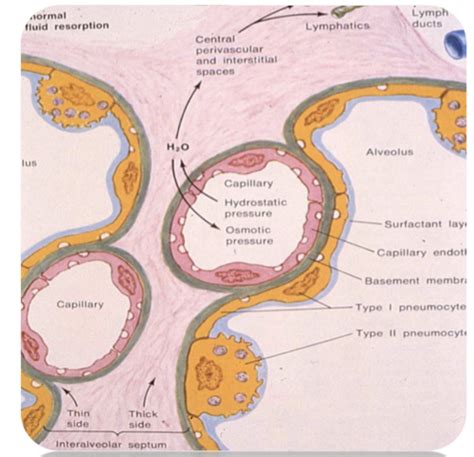 Pathology of Pulmonary Vascular Disease Flashcards | Quizlet