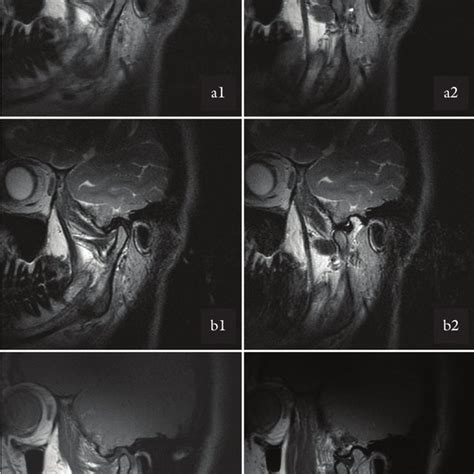 Examples of images in the parasagittal plane (zoom) for different... | Download Scientific Diagram