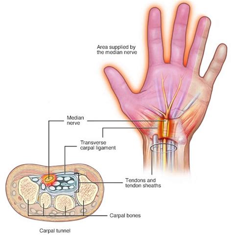 Nerve compression causes, symptoms, diagnosis & treatment