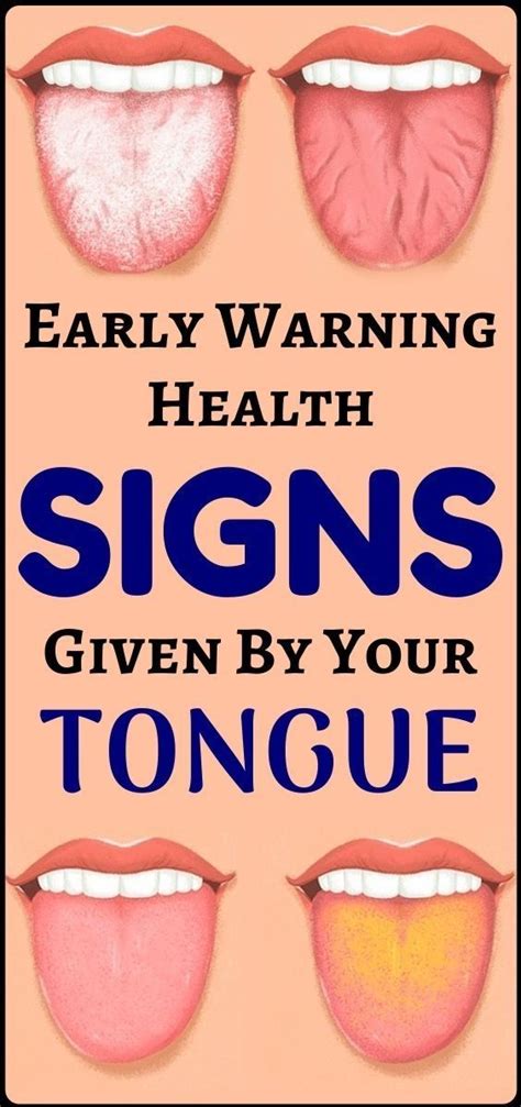 What Does Your Tongue Say About Your Health? - Quoqlee