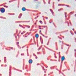 a. Spores and bacteria of Clostridium tetani with a typical drum-stick... | Download Scientific ...