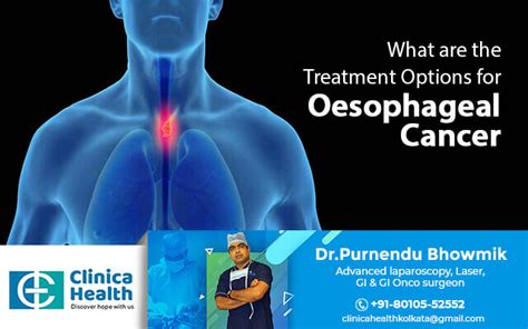 What are the Treatment Options for Oesophageal Cancer