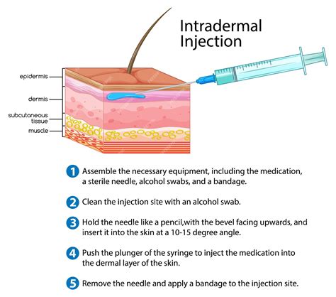 Intradermal Injection Sites