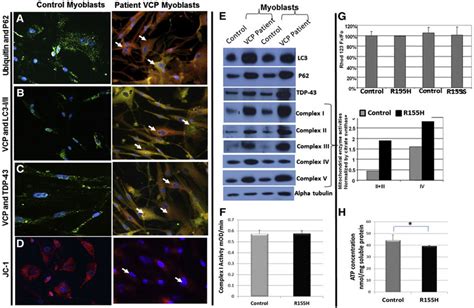 Measurements of mitochondrial membrane potential, enzyme complex ...