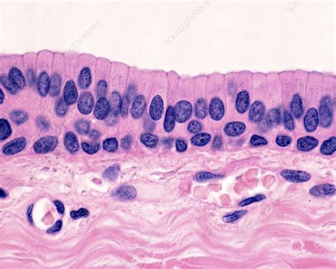 Stratified columnar tissue (image from web) | Parts of the eye, Histology slides, Human anatomy ...