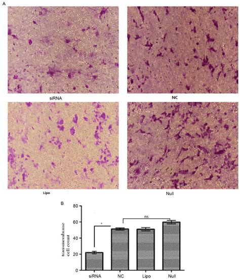 Transwell assay analysis of cell migration. (A) Representative images... | Download Scientific ...