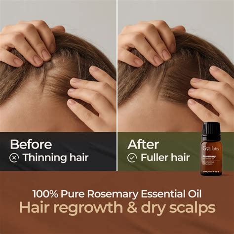 Rosemary Oil Before And After: Hair Loss Results