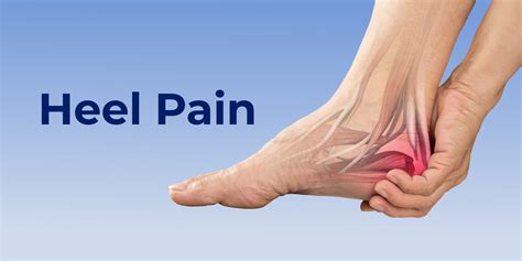 Heel Pain Treatment: A Guide To Finding Relief