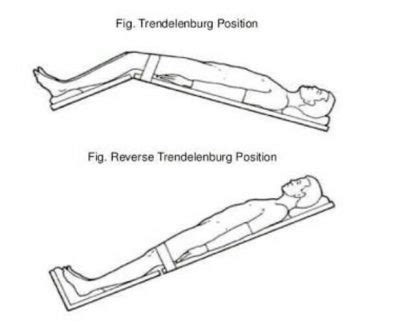 Patient Positioning | Trendelenburg and Reverse Trendelenburg