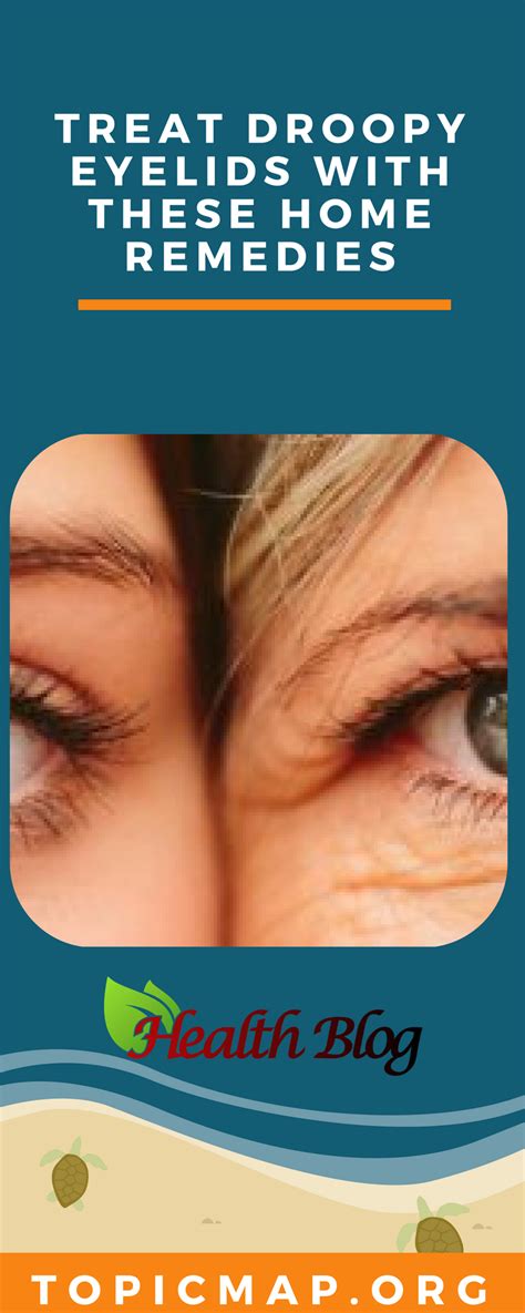 Treat Droopy Eyelids With These Home Remedies | Anti aging skin ...