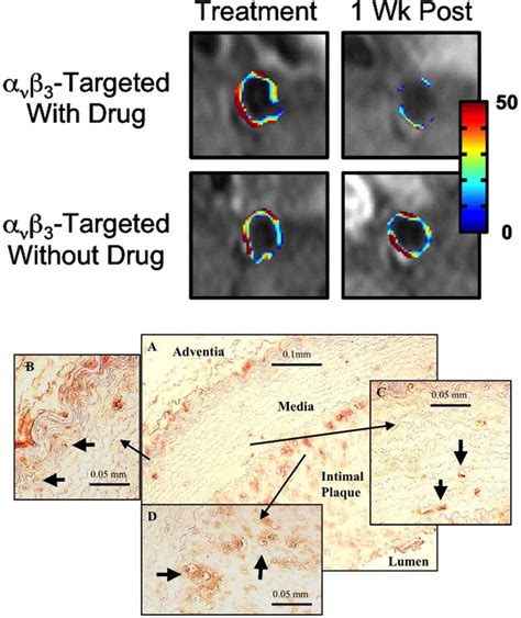 Perfluorocarbon nanoparticles for physiological and molecular imaging ...