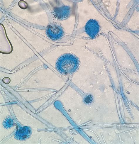 Aspergillus flavus - Chaetomium Queen in 2023 | Medical laboratory science, Microbiology ...