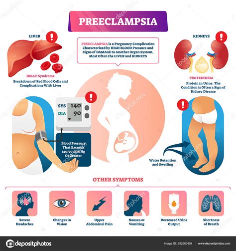 Preeclampsia Proteinuria