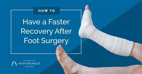 Catch the Wave to a Faster Recovery After Foot Surgery: Advanced Foot ...