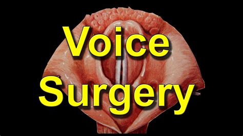 How is surgery for hoarse voice (microlaryngoscopy, vocal cord surgery) performed? - YouTube