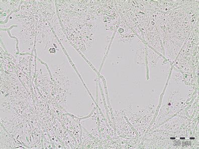 Diagnosis of Dermatophytosis | SpringerLink