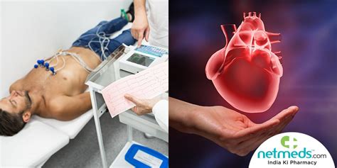 Electrocardiogram (ECG) Test: Procedure, Results And Risks