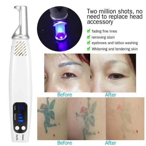 Pro Laser Picosecond Pen Blue&Red Remove Tattoo Laser Pen Freckle Acne ...