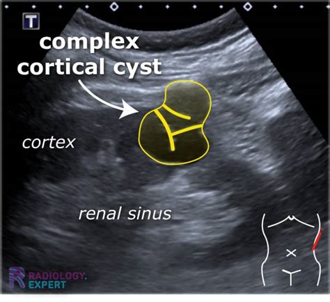 Abdominal ultrasound