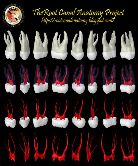 The Root Canal Anatomy Project: Mandibular First Premolar