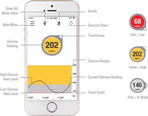 Dexcom Continuous Glucose Monitoring (CGM) System