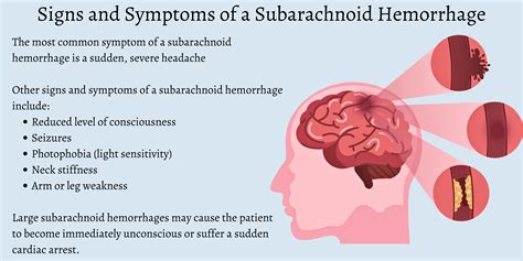 뇌출혈 지주막하출혈 거미막하출혈 SAH subarachnoid hemorrhage 증상 원인 치료 수술 예후 합병증 ...