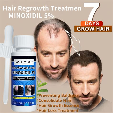 Aggregate 133+ minoxidil hair growth - camera.edu.vn